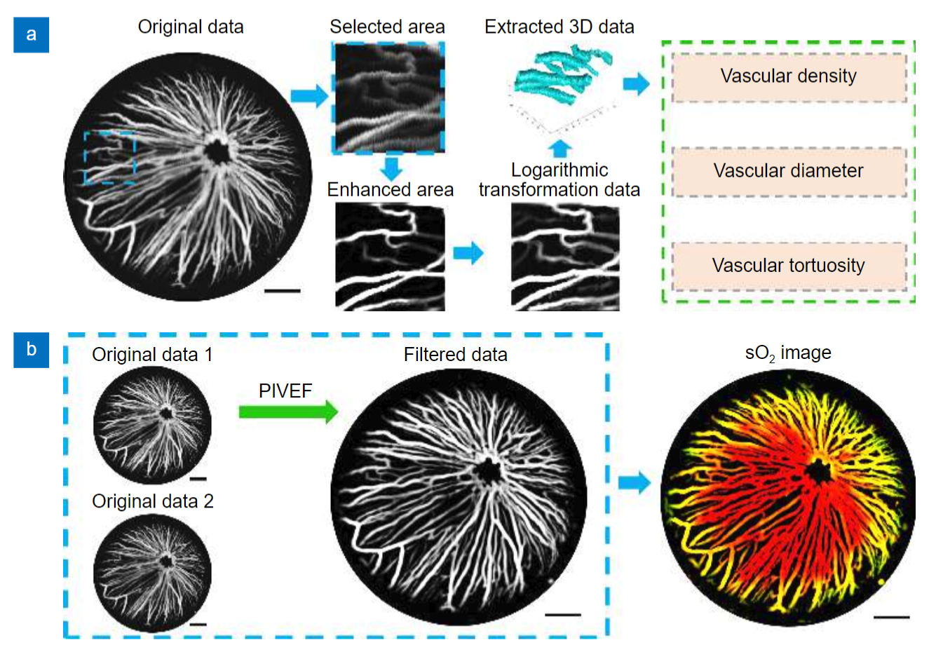 Customized anterior segment photoacoustic imaging for ophthalmic burn evaluation in vivo_4