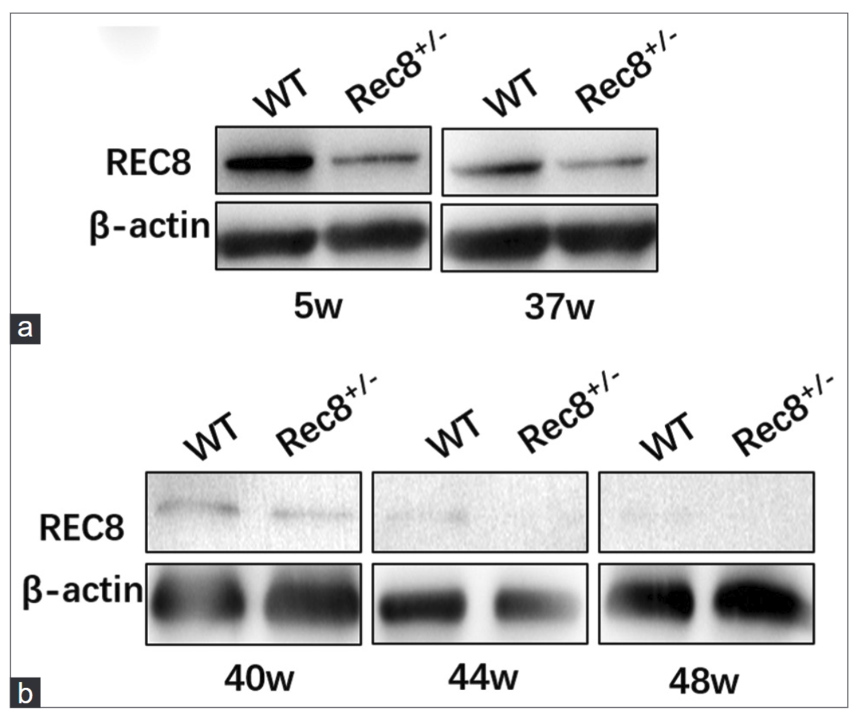 Age-cumulative effect of REC8 reduction on meiotic chromosome segregation errors in mice_4